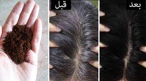 التخلص من الشعر الأبيض
