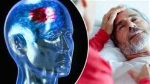 دراسة حديثة تحذر من تناول هذا المشروب الشهير يسبب السكتة الدماغية
