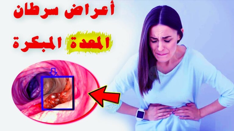اكتشفها فوراً..علامة على الوجه قد تدل على ورم في المعدة 