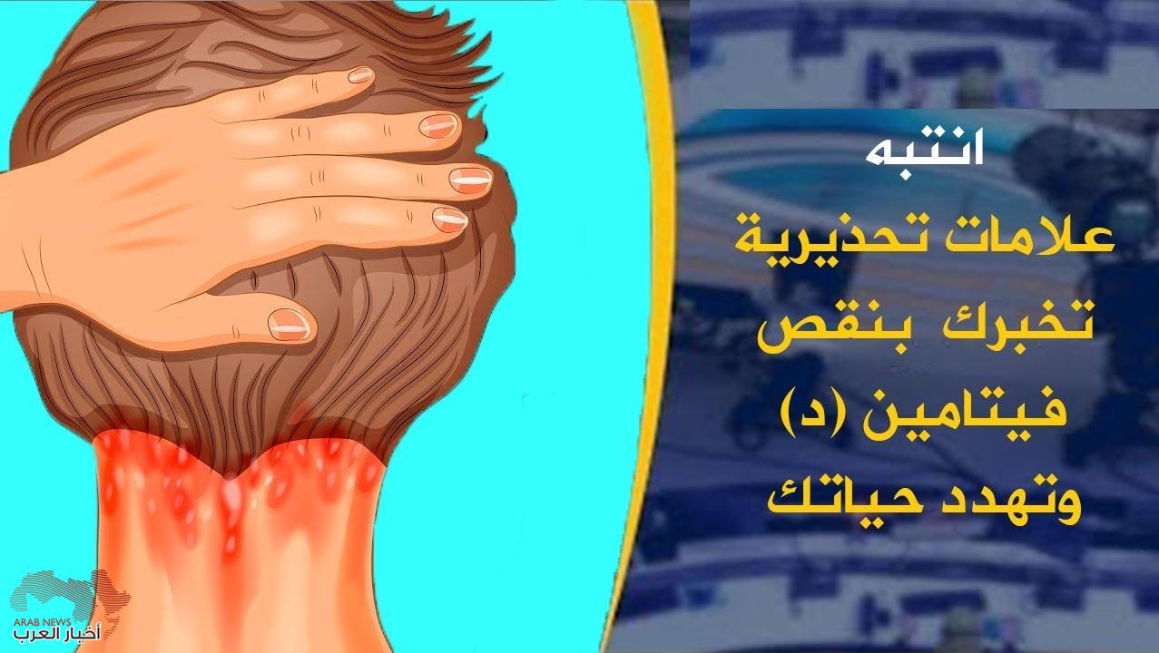 اعراض نقص فيتامين د