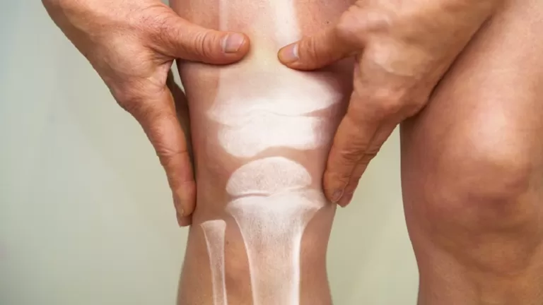 احرص على تناولها.. هذه الأطعمة الشائعة تقلل من آلام المفاصل وفوائد صحية اخرى!