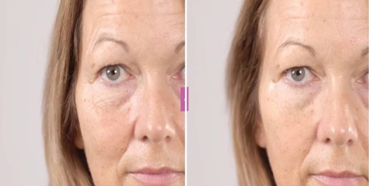 كريم The Eye Lift 