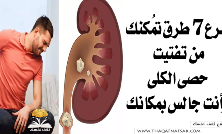 تفتيت الحصى