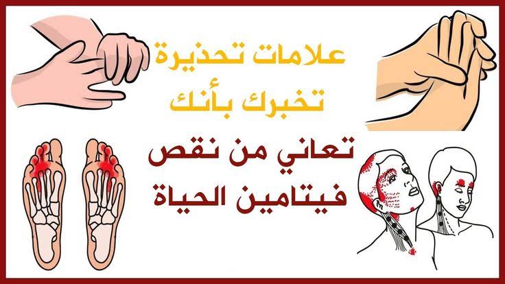 نقص فيتامينات
