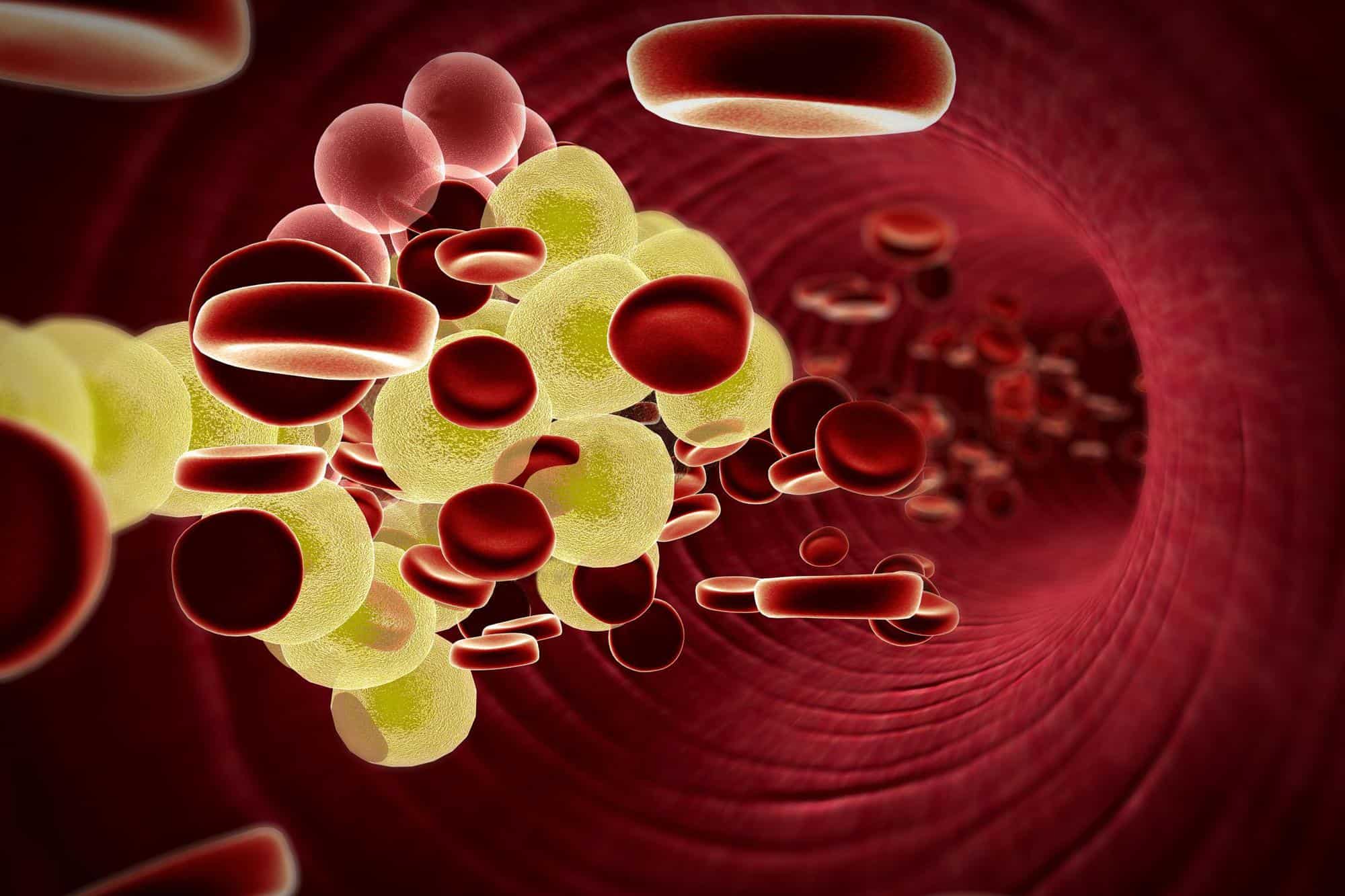 هذه العلامة اذا رأيتها في البراز فإن نسبة الكوليسترول في الدم مرتفعة بصورة خطيرة ..تدارك نفسك قبل فوات الأوان 