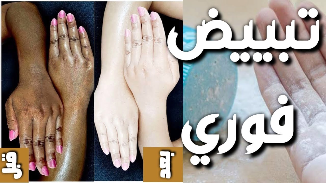 للعرائس فقط ..  تبييض الوجه والجسم في دقائق ضعي هذه الخلطة قبل الاستحمام وسيزول سواد سنين من البشرة بأول استخدام