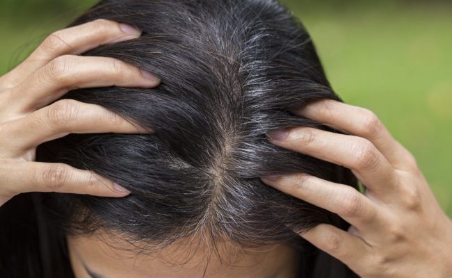الملح لازالة الشعر الأبيض