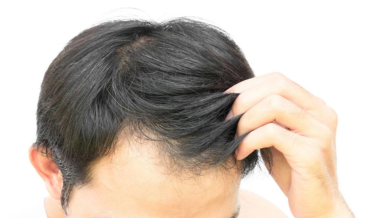 الشعر