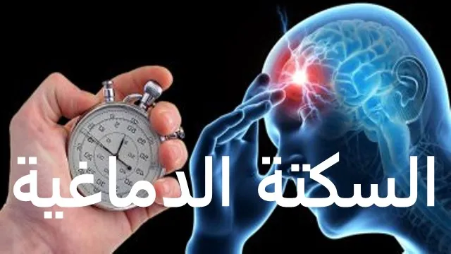  عادات شائعة يمارسها الكثير تؤدي مع الوقت للإصابة بالسكتة الدماغية