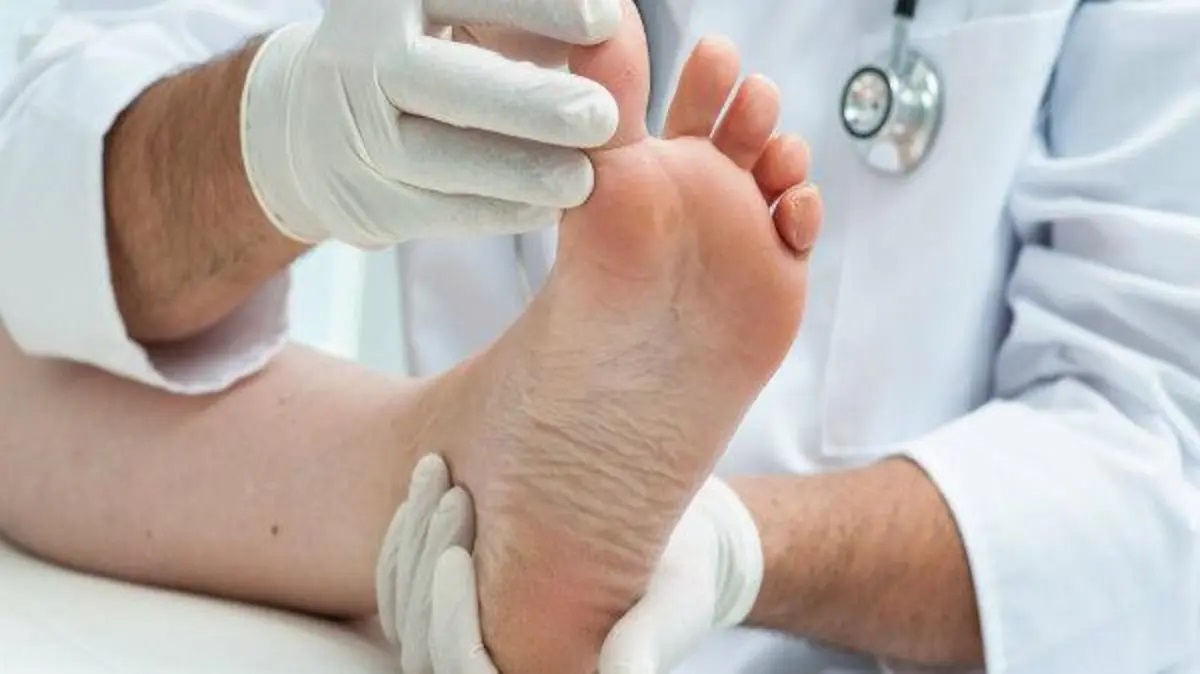 علامات ارتفاع الكلسترول في الساق