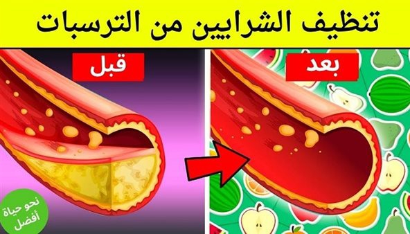 ملعقة تنظيف الشــرايين ستخرج من شراينك دهــون ملتـصقة ومتراكمة لم تخرج من سنوات ستنعش قلبك