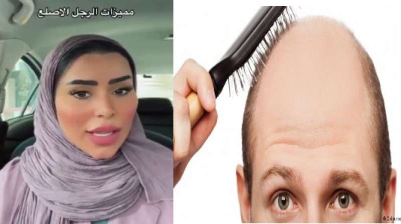 شاهد مشهورة سعودية تعبر عن إعجابها بالرجل الأصلع لسبب صادم لا يخطر على البال
