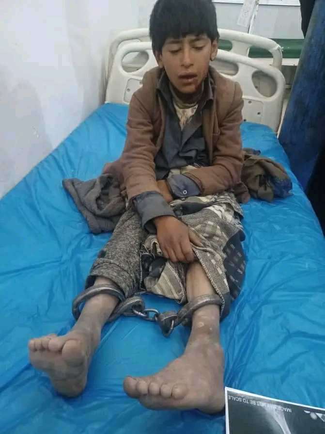 طفل يمني مقيد بالسلاسل