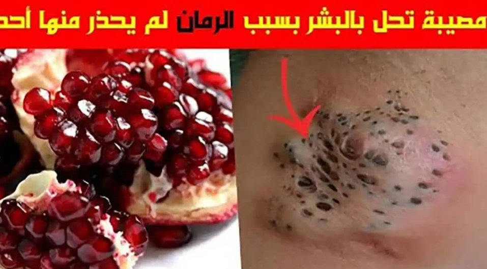 بالرغم من الفوائد التي يحتوي عليها الرمان إلا أن هناك أجزاء منها ضارة ويجب الحذر وعدم تناولها فماهي هذه الأضرار