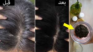 لاتهملها .. طرق بسيطه لمعالجة الشيب المبكر والشعر الأبيض والسبب الرئيسي لظهوره!
