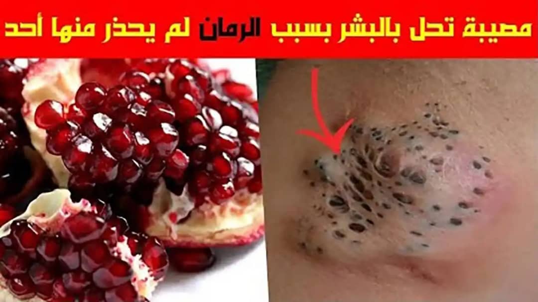 سم قد يقتلك .. تناول فاكهة الرمان بهذه الطريقة تقرب من أجلك من حيث لا تعلم؟