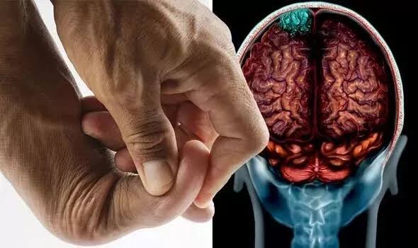 علامة في القدم تشير لورم في الدماغ