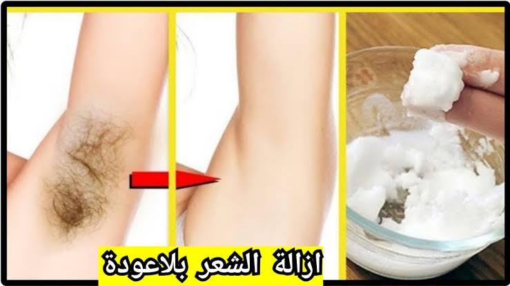 ازالة الشعر بالملح