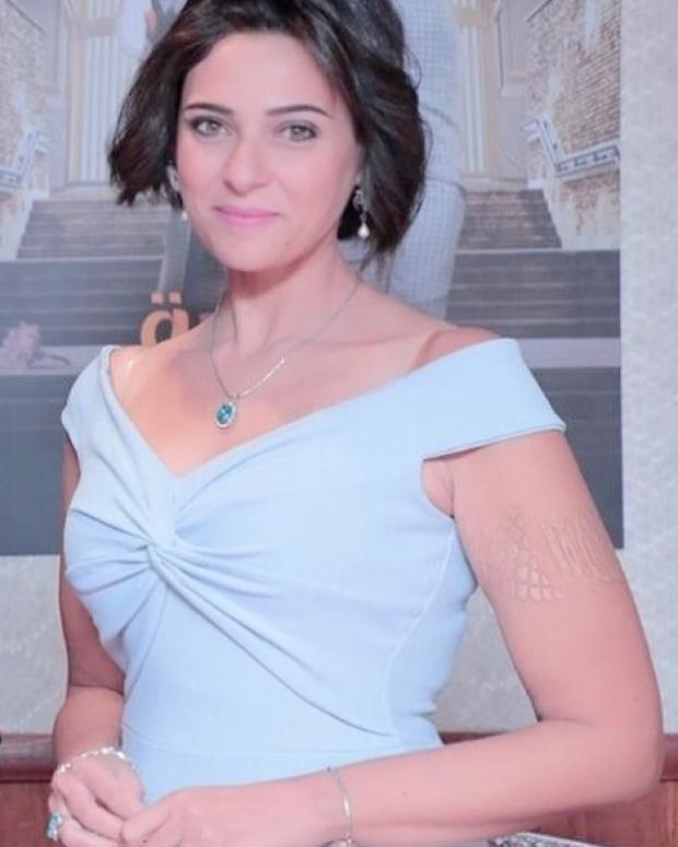 الفنانة نورهان