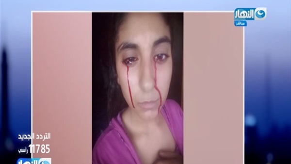 دم في عيون فتاة مصرية