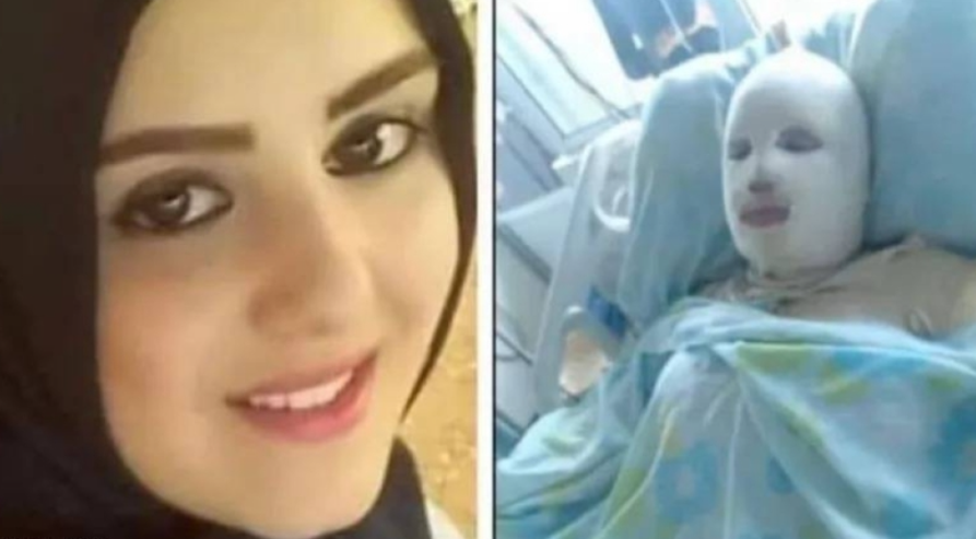 قتل زوجته حرقا بالنار ولن تصدق ماهو السبب 