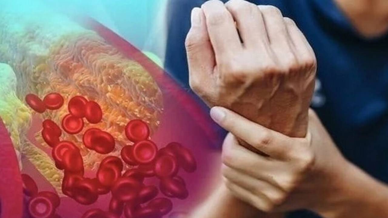أسوأ طعام يتسبب في ارتفاع الكوليسترول بشكل خطير ابتعد عنه فوراً