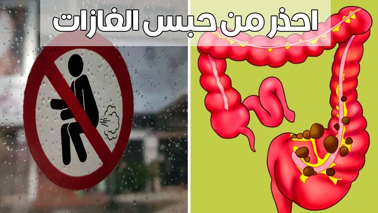 اضرار حبس الغازات