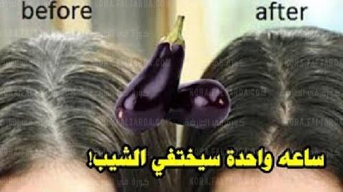 علاج الشيب