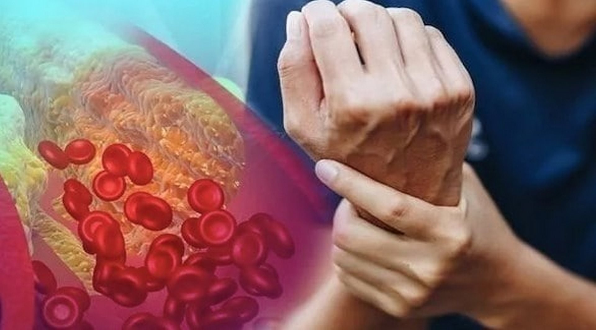 سم قاتل يفقدك حياتك بلمح البصر .. اسوأ طعام يتسبب في ارتفاع الكوليسترول بشكل خطير للغاية !
