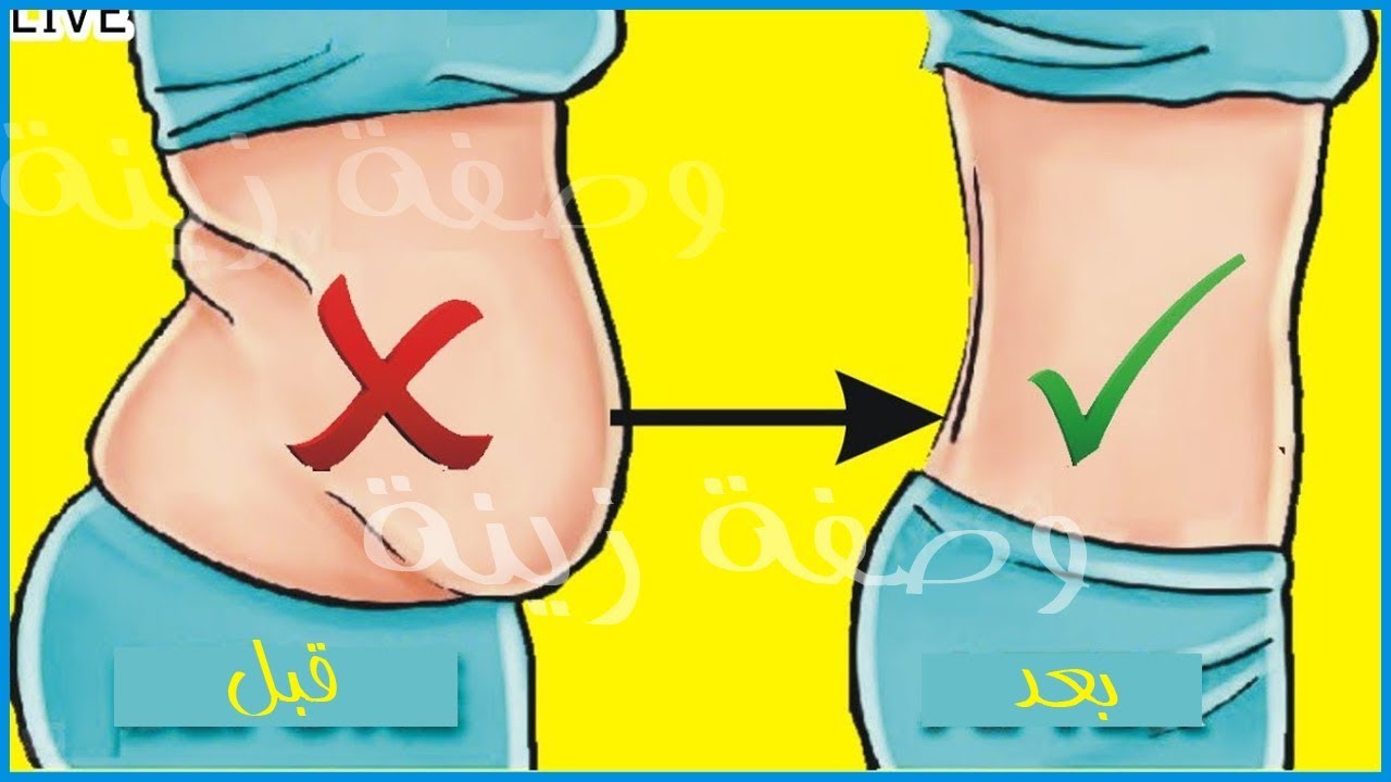 تخسيس الكرش