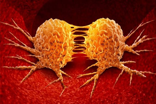 طبيب سعودي يفجر مفاجأة .. احذر اذا ظهرت لديك واحدة من هذه العلامات فأنت مصاب بالسرطان