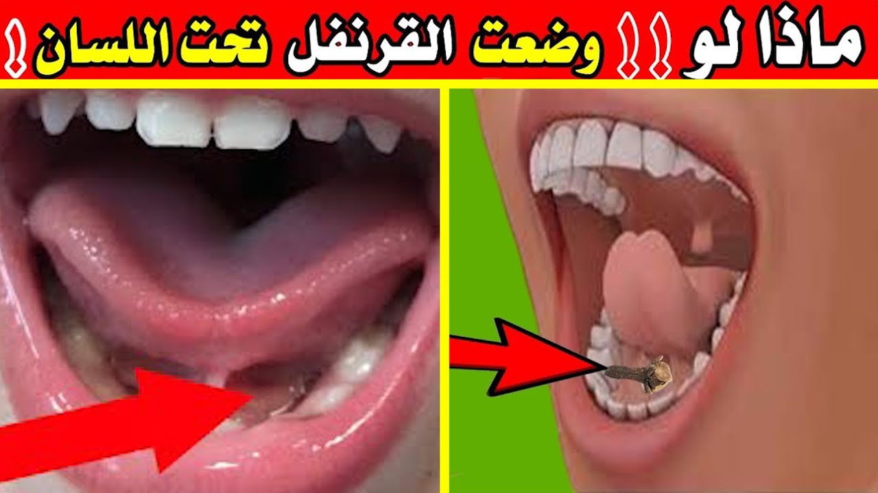 معجزة القرنفل تحت اللسان