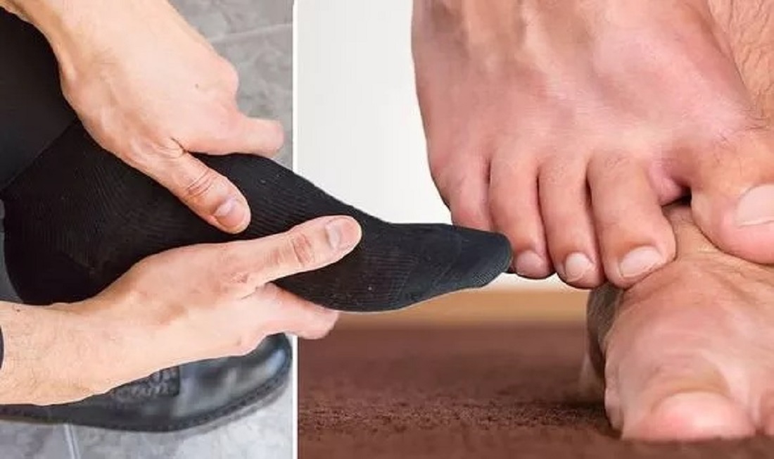علامة على القدمين 