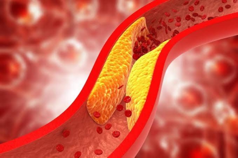إكتشف سر نوع من الخضار يخفض ضغط الدم والكوليسترول