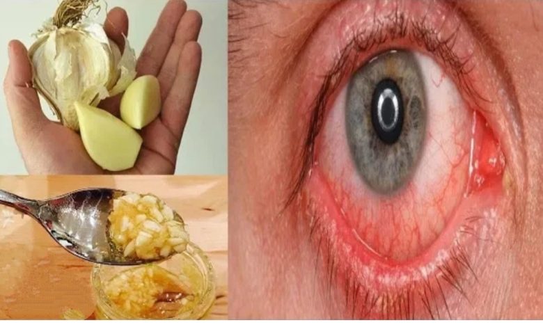  معجزة تحسين النظر في اقل من شهر.. حبة واحدة فقط للقضاء على ضعف النظر نهائيا.. شاهد