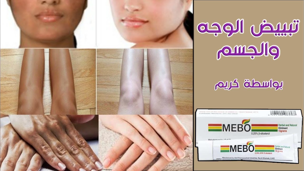 كريم معجزة في جميع الصيدليات ضعيه على البشرة هيرجعك 10 سنين ورا بهذه الوصفة العبقرية 