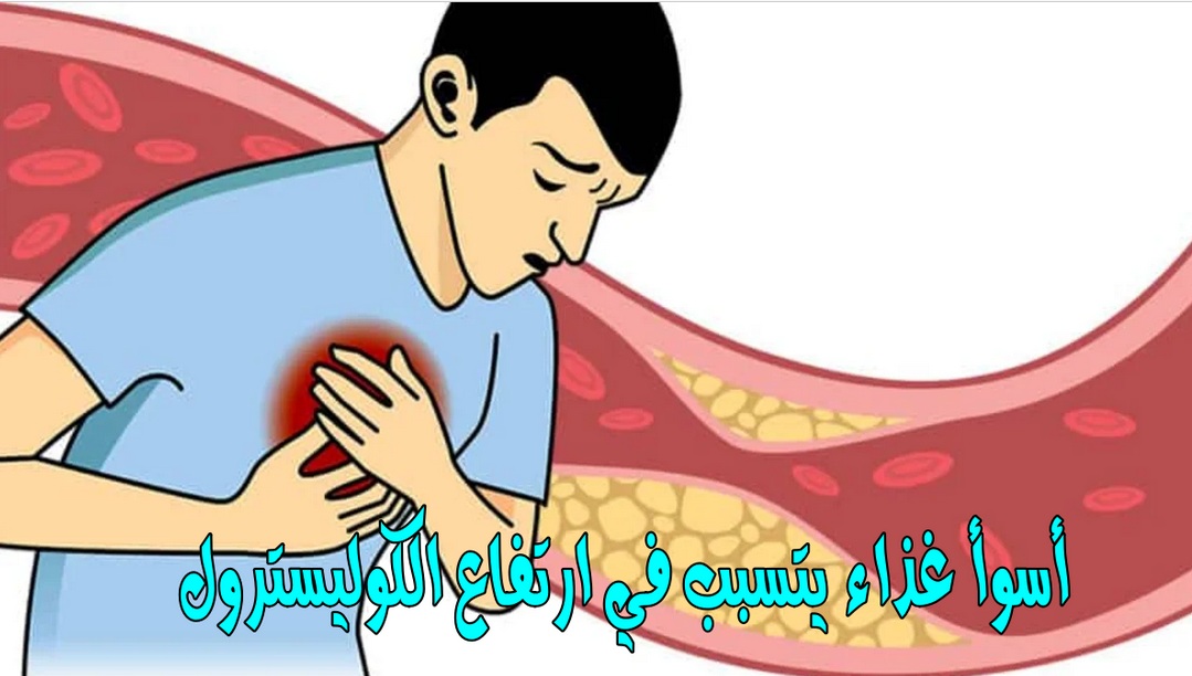 كوليسترول
