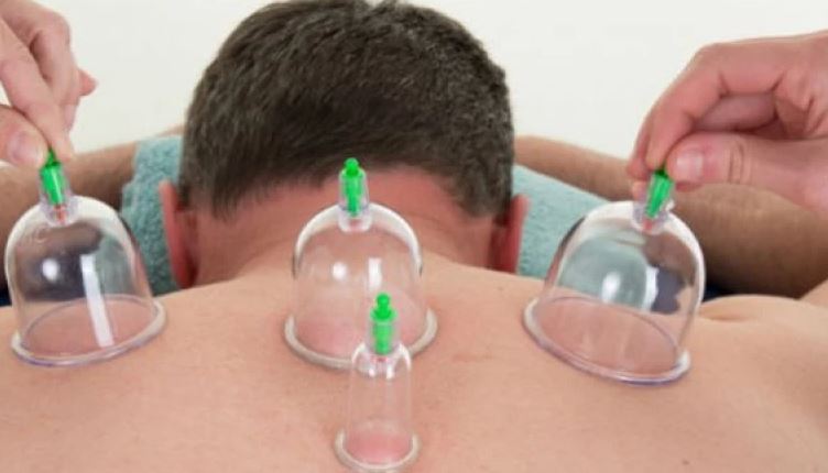 دكتور سعودي يكشف عن 8 فئات قد تواجه الموت بسبب الحجامة .. تعرف عليها